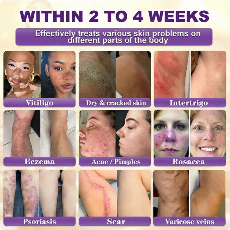 ✨Rolimey®👨‍⚕️ Biotin 10-in-1 Skin Restoration Cream —Tightening for Skin Types 🍀