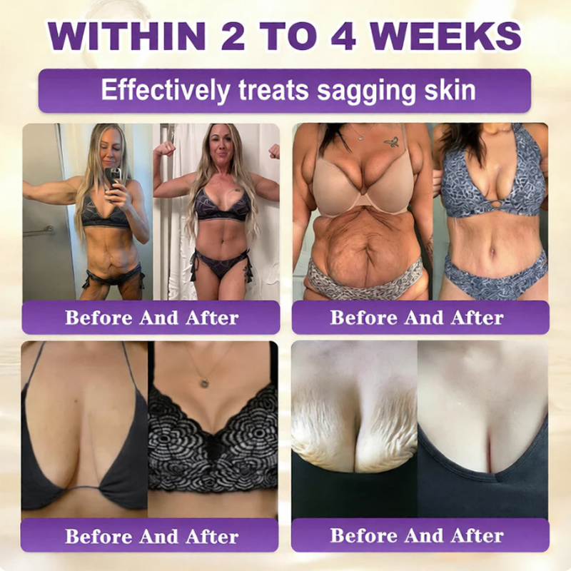 ✨Rolimey®👨‍⚕️ Biotin 10-in-1 Skin Restoration Cream —Tightening for Skin Types 🍀