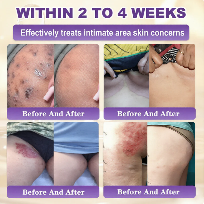 ✨Rolimey®👨‍⚕️ Biotin 10-in-1 Skin Restoration Cream —Tightening for Skin Types 🍀
