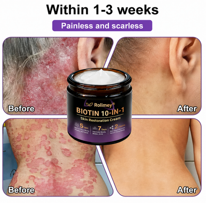 ✨Rolimey®👨‍⚕️ Biotin 10-in-1 Skin Restoration Cream —Tightening for Skin Types 🍀