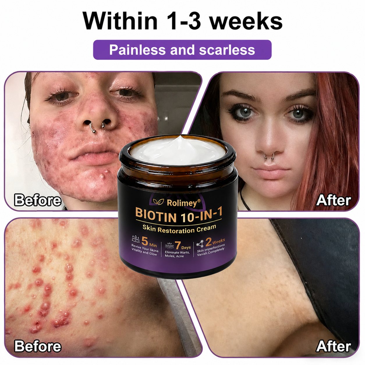 ✨Rolimey®👨‍⚕️ Biotin 10-in-1 Skin Restoration Cream —Tightening for Skin Types 🍀