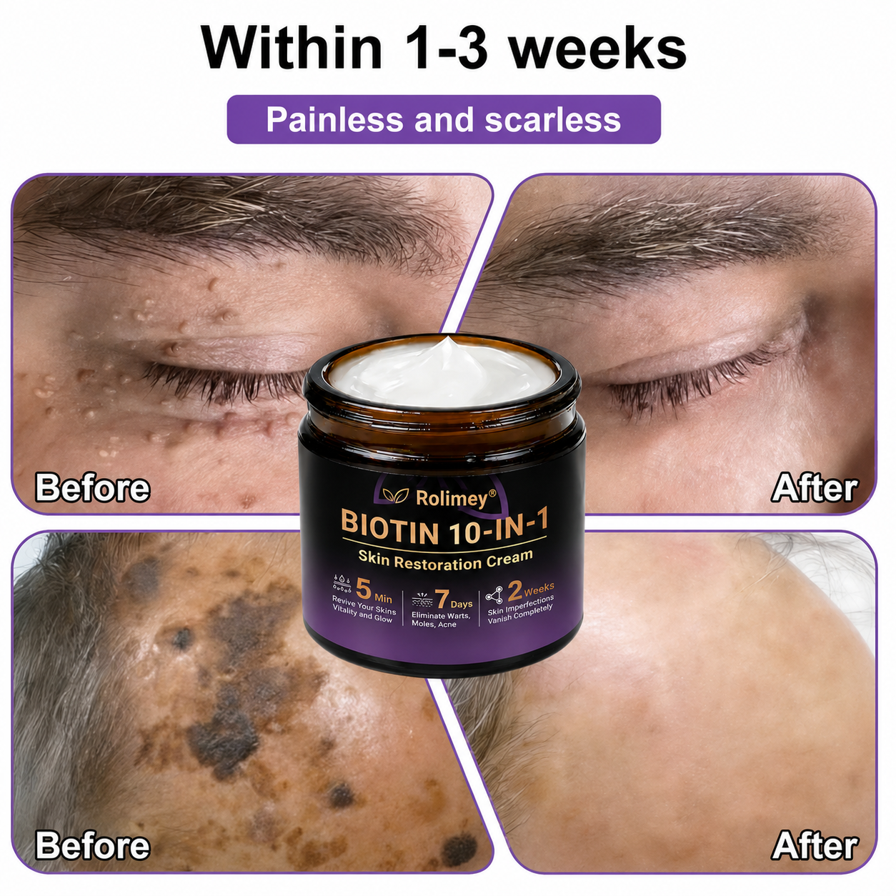 ✨Rolimey®👨‍⚕️ Biotin 10-in-1 Skin Restoration Cream —Tightening for Skin Types 🍀