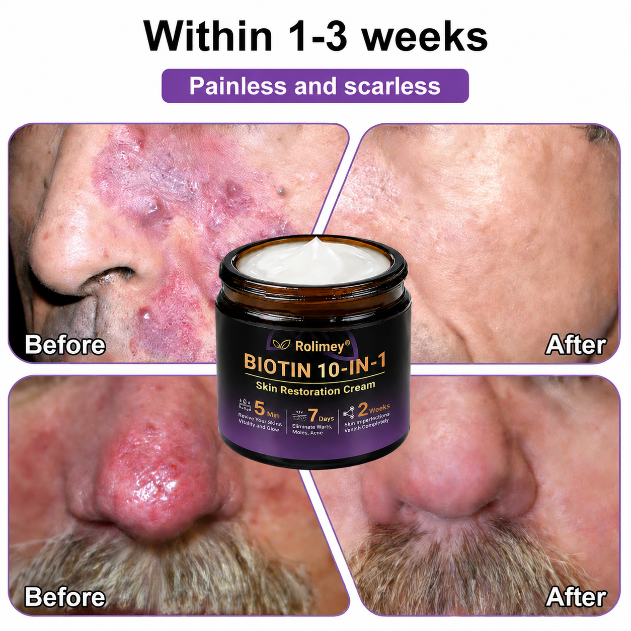 ✨Rolimey®👨‍⚕️ Biotin 10-in-1 Skin Restoration Cream —Tightening for Skin Types 🍀