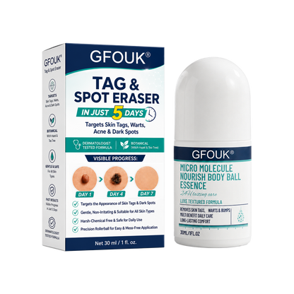 𝐎𝐟𝐟𝐢𝐜𝐢𝐚𝐥 𝐁𝐫𝐚𝐧𝐝 𝐒𝐭𝐨𝐫𝐞 |👨‍⚕️❤️GFOUK® 5-𝐷𝑎𝑦 𝗧𝐚𝐠 & 𝗦𝗽𝐨𝐭 𝐄𝐫𝒂𝒔𝒆𝒓(Zero Pain, Zero 𝐒𝐜𝐚𝒓𝒔 Rollerball)