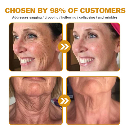 🌟💎 Rolimey® Bee venom Pro Comprehensive Cream —Tightening for Skin Types 🔥
