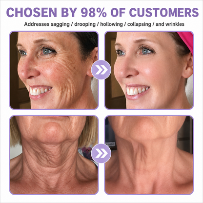 🔥 Rolimey® Advanced Biotin & Peptide Skin Restoration Cream—Tightening for Skin Types 🔥