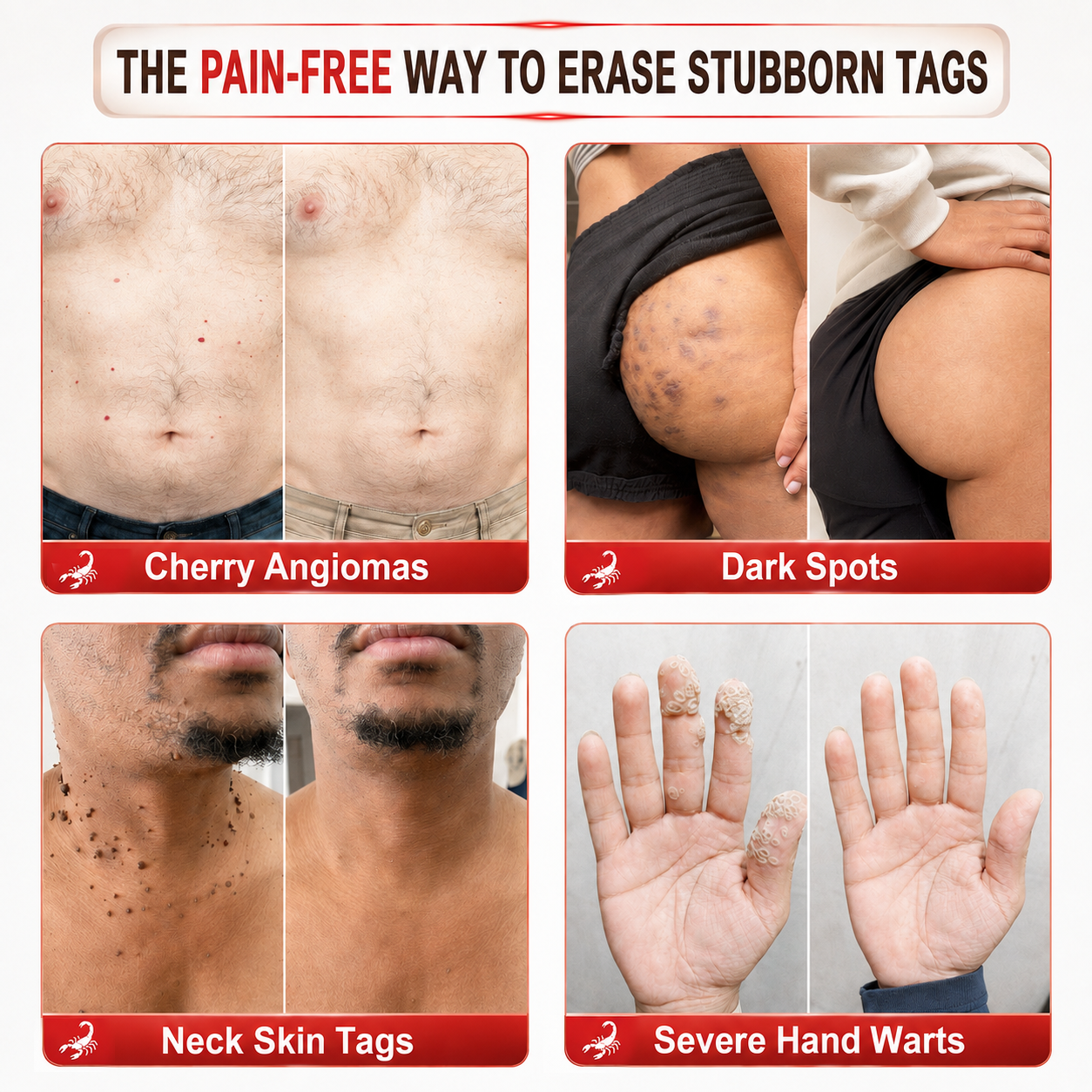 𝐎𝐟𝐟𝐢𝐜𝐢𝐚𝐥 𝐁𝐫𝐚𝐧𝐝 𝐒𝐭𝐨𝐫𝐞 |👨‍⚕️✨ Scorpion Skin Care Cream | Advanced Skin Smoothing Treatment for Spots & Uneven Skin Appearance