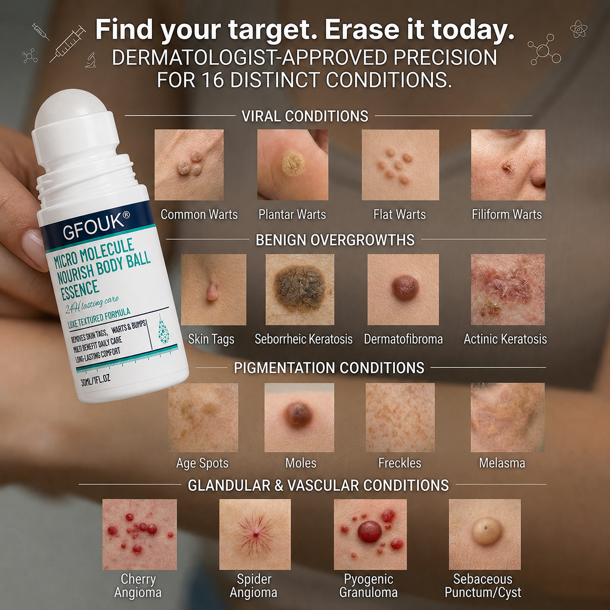 𝐎𝐟𝐟𝐢𝐜𝐢𝐚𝐥 𝐁𝐫𝐚𝐧𝐝 𝐒𝐭𝐨𝐫𝐞 |👨‍⚕️❤️GFOUK® 5-𝐷𝑎𝑦 𝗧𝐚𝐠 & 𝗦𝗽𝐨𝐭 𝐄𝐫𝒂𝒔𝒆𝒓(Zero Pain, Zero 𝐒𝐜𝐚𝒓𝒔 Rollerball)