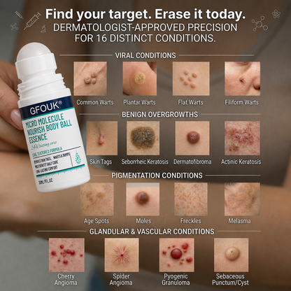 𝐎𝐟𝐟𝐢𝐜𝐢𝐚𝐥 𝐁𝐫𝐚𝐧𝐝 𝐒𝐭𝐨𝐫𝐞 |👨‍⚕️❤️GFOUK® 5-𝐷𝑎𝑦 𝗧𝐚𝐠 & 𝗦𝗽𝐨𝐭 𝐄𝐫𝒂𝒔𝒆𝒓(Zero Pain, Zero 𝐒𝐜𝐚𝒓𝒔 Rollerball)