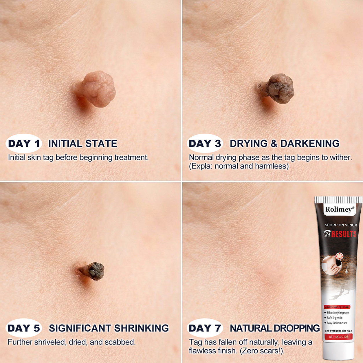 𝐎𝐟𝐟𝐢𝐜𝐢𝐚𝐥 𝐁𝐫𝐚𝐧𝐝 𝐒𝐭𝐨𝐫𝐞 |👨‍⚕️✨ Scorpion Skin Care Cream | Advanced Skin Smoothing Treatment for Spots & Uneven Skin Appearance