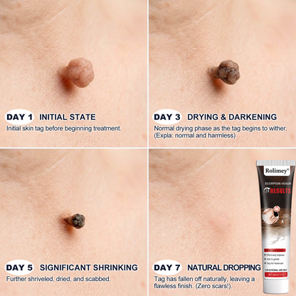 𝐎𝐟𝐟𝐢𝐜𝐢𝐚𝐥 𝐁𝐫𝐚𝐧𝐝 𝐒𝐭𝐨𝐫𝐞 |👨‍⚕️✨ Scorpion Skin Care Cream | Advanced Skin Smoothing Treatment for Spots & Uneven Skin Appearance