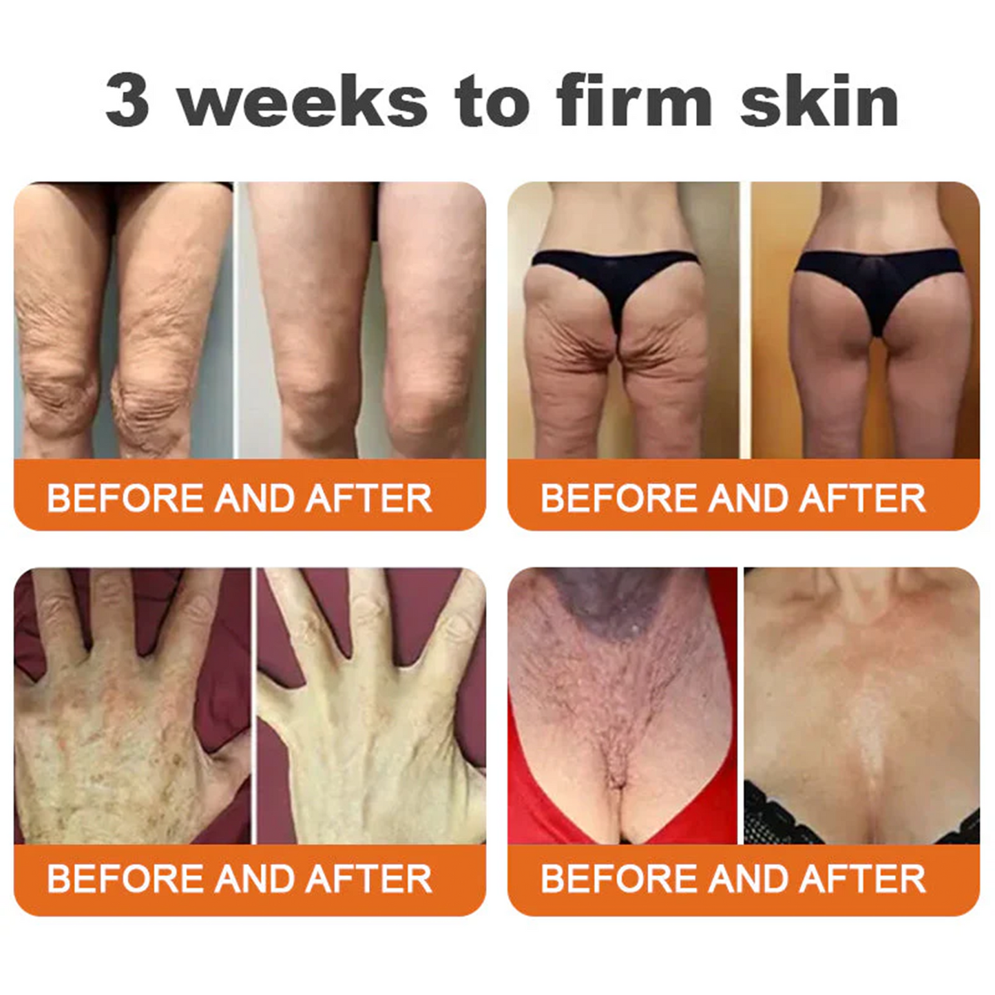 👨‍⚕️👨‍⚕️: Bee Venom · Botox Advanced Skin Rescue — Specifically Formulated for Paper-Thin, Fragile & Easy-Bruising Skin