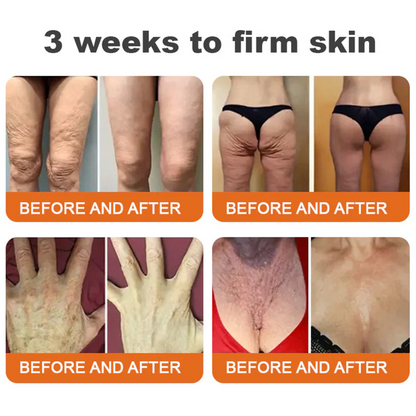 👨‍⚕️👨‍⚕️: Bee Venom · Botox Advanced Skin Rescue — Specifically Formulated for Paper-Thin, Fragile & Easy-Bruising Skin