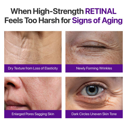 💜Rolimey®No.9NAD+ Retinal Shot Eye Cream ✨ Advanced Firming & Renewal Treatment with Retinoid, Peptides & Niacinamide