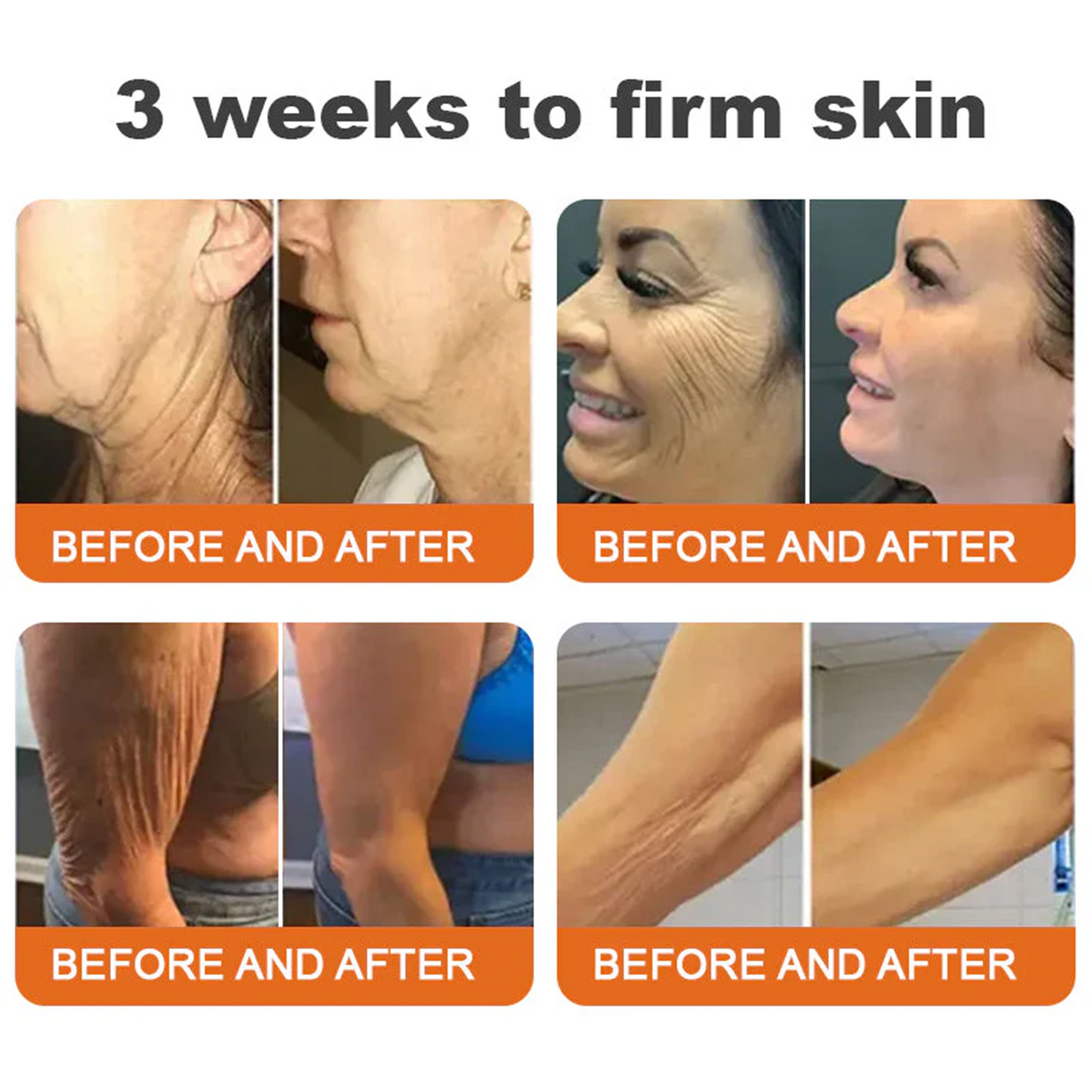 👨‍⚕️👨‍⚕️: Bee Venom · Botox Advanced Skin Rescue — Specifically Formulated for Paper-Thin, Fragile & Easy-Bruising Skin