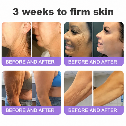 🔥 Rolimey® Advanced Biotin & Peptide Skin Restoration Cream—Tightening for Skin Types 🔥